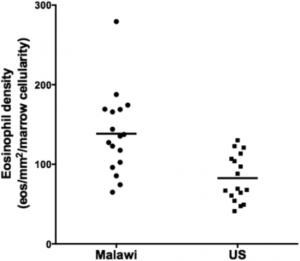 This scatter plot shows increased eosinophil density in bone marrow biopsies from Malawi relative to the United States. 17 patients with lymphoma were tested for both Malawi and the US. Median values are indicated by a horizontal line (Malawi = 135.4, United States = 69.2; P = 0.0005).