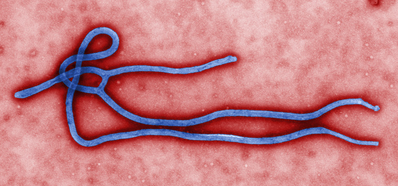 ebola-virus-credit-cdc